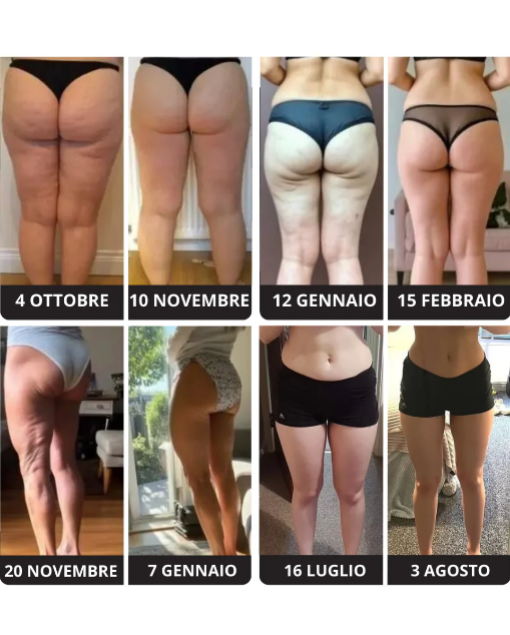 CelluLift® – Dispositivo Drenante AntiCellulite